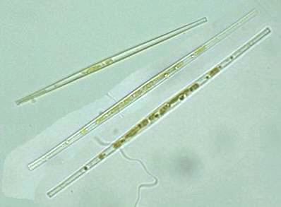 Synedra acus